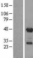 APOBEC3G Human Over-expression Lysate