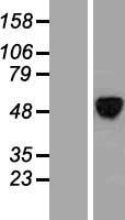 ALX4 Human Over-expression Lysate