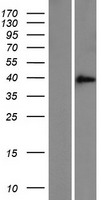 ZFAND3 Human Over-expression Lysate