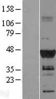 DMRT1 Human Over-expression Lysate