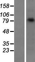 gamma Catenin (JUP) Human Over-expression Lysate