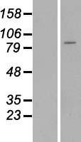 ST14 Human Over-expression Lysate