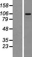 MTBP Human Over-expression Lysate