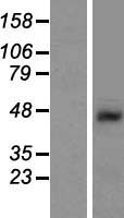 SHFM3 (FBXW4) Human Over-expression Lysate