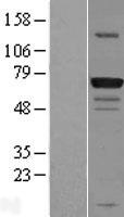 GPATCH3 Human Over-expression Lysate