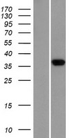 PRSS22 Human Over-expression Lysate