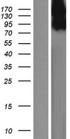 DENTT (TSPYL2) Human Over-expression Lysate