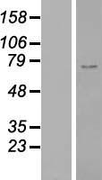 ZNF667 Human Over-expression Lysate