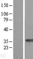 PBLD Human Over-expression Lysate