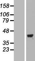 MAP1 (MOAP1) Human Over-expression Lysate