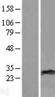 RAB38 Human Over-expression Lysate