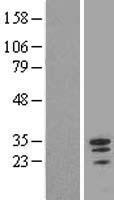 Myeloid leukemia factor 1 (MLF1) Human Over-expression Lysate