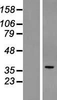 POPDC3 Human Over-expression Lysate