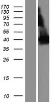 PDE4DIP Human Over-expression Lysate