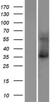 KCNK15 Human Over-expression Lysate