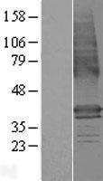 LMBR1 Human Over-expression Lysate