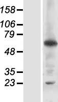 RNF25 Human Over-expression Lysate