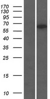 TTC31 Human Over-expression Lysate