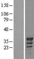 TSPY2 Human Over-expression Lysate