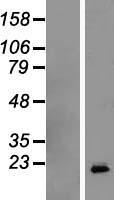 Growth Hormone (GH1) Human Over-expression Lysate