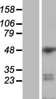 ESS2 Human Over-expression Lysate