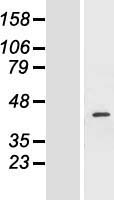 FANCF Human Over-expression Lysate
