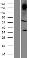 FNDC3B Human Over-expression Lysate