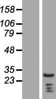 C1orf149 (MEAF6) Human Over-expression Lysate