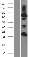 EPS8L2 Human Over-expression Lysate