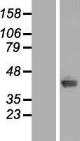 C1orf80 (AIDA) Human Over-expression Lysate
