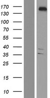 YTHDC2 Human Over-expression Lysate