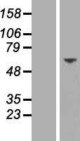 DCLRE1B Human Over-expression Lysate