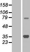 SMN1 Human Over-expression Lysate