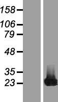 CBFB Human Over-expression Lysate