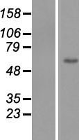 ZNF649 Human Over-expression Lysate