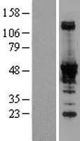 NADK Human Over-expression Lysate