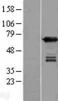 UPF3B Human Over-expression Lysate