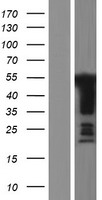 GPBP1 Human Over-expression Lysate