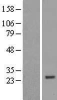 ZNF747 Human Over-expression Lysate