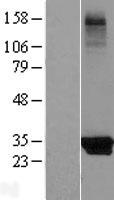 KCTD14 Human Over-expression Lysate