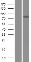 Acetoacetyl CoA synthetase (AACS) Human Over-expression Lysate