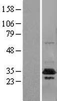 CUEDC2 Human Over-expression Lysate