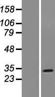 MOSPD3 Human Over-expression Lysate