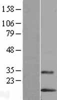 LYNX1 Human Over-expression Lysate
