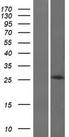 HOXB8 Human Over-expression Lysate