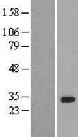 HOXA6 Human Over-expression Lysate
