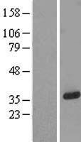 TMEM38A Human Over-expression Lysate