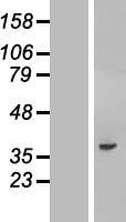 C20orf195 (FNDC11) Human Over-expression Lysate