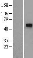 CCDC86 Human Over-expression Lysate