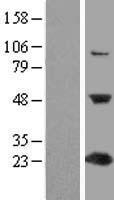 C1orf50 Human Over-expression Lysate